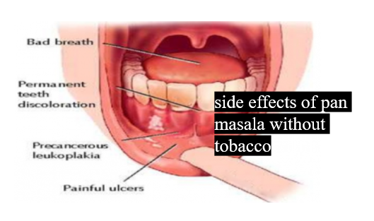 Understanding the Side-Effects of Tobacco-Free Pan Masala