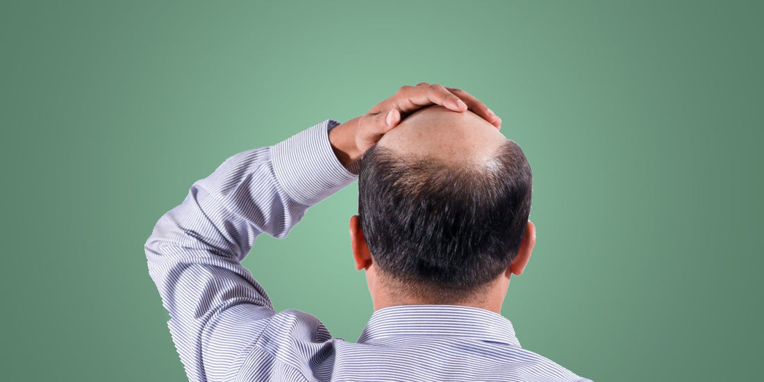 The Lesser Known Side Effects Of Smoking: A Deteriorating Hair Health