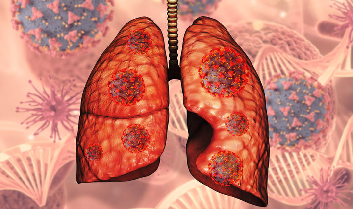 Respiratory Diseases Due To Smoking Cigarettes