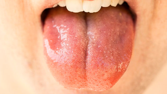 Tongue Taste Buds Image