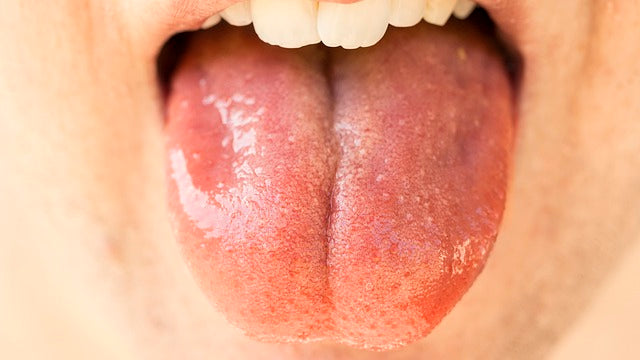 Tongue Taste Buds Image